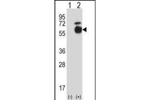 Western blot analysis of Acvr1 (arrow) using rabbit polyclonal Mouse Acvr1 Antibody (Center) (ABIN657718 and ABIN2846706).