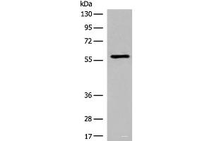Western blot analysis of Jurkat cell lysate using M1AP Polyclonal Antibody at dilution of 1:600 (Meiosis 1 Associated Protein (M1AP) anticorps)