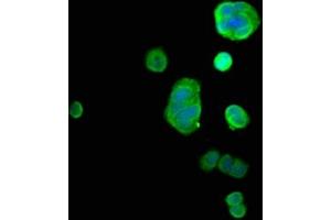 Immunofluorescence staining of MCF-7 cells with ABIN7166949 at 1:66, counter-stained with DAPI. (GDI1 anticorps  (AA 35-170))