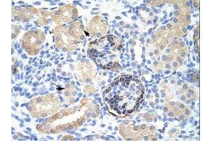 Image no. 1 for anti-Chloride Intracellular Channel 5 (CLIC5) (C-Term) antibody (ABIN202126)