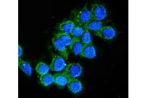 anti-Cathepsin D (CTSD) (AA 201-412) antibody