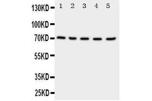 Anti-NRG1 antibody, Western blotting Lane 1: Rat Spleen Tissue Lysate Lane 2: Rat Kidney Tissue Lysate Lane 3: Rat Brain Tissue Lysate Lane 4: HELA Cell Lysate Lane 5: SMMC Cell Lysate (Neuregulin 1 anticorps  (C-Term))