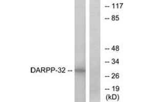 Western blot analysis of extracts from COS7 cells, treated with forskolin 40nM 30', using DARPP-32 (Ab-34) Antibody. (DARPP32 anticorps  (AA 18-67))