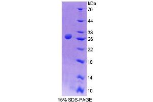 SDS-PAGE (SDS) image for Alanine Glyoxylate Aminotransferase (AGXT) (AA 120-334) protein (His tag) (ABIN4989131) (AGXT Protein (AA 120-334) (His tag))