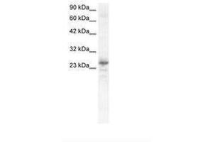 Image no. 1 for anti-NK2 Homeobox 8 (NKX2-8) (C-Term) antibody (ABIN6735828) (NKX2-8 anticorps  (C-Term))