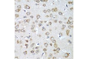 Immunohistochemistry of paraffin-embedded mouse brain using EIF1AX antibody at dilution of 1:100 (40x lens). (EIF1AX anticorps)