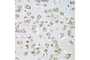 Immunohistochemistry of paraffin-embedded mouse brain using EIF1AX antibody at dilution of 1:100 (40x lens).