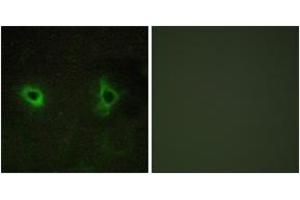 Immunofluorescence analysis of COS7 cells, using Collagen IV alpha3 Antibody.