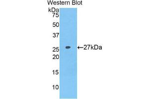 Western Blotting (WB) image for anti-Coagulation Factor IX (F9) (AA 232-455) antibody (ABIN1858771) (Coagulation Factor IX anticorps  (AA 232-455))