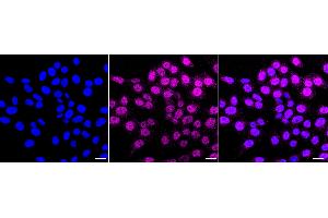 Immunocytochemical staining of HepG2 cells with Annexin A7 antibody (ABIN7797626), 1:1,000). (Recombinant Annexin VII anticorps)