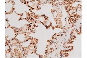 ABIN6267502 at 1/200 staining Rat lung tissue sections by IHC-P.
