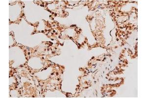 ABIN6267502 at 1/200 staining Rat lung tissue sections by IHC-P.