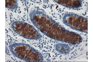 Immunohistochemical staining of paraffin-embedded Human colon tissue using anti-AP2M1 mouse monoclonal antibody. (AP2M1 anticorps  (AA 97-383))