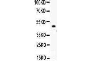 Western Blotting (WB) image for anti-Kinesin Family Member 2C (KIF2C) (AA 531-725) antibody (ABIN3043278)