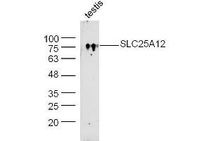 Mouse testis lysate probed with Rabbit Anti-SLC25A12/ARALAR Polyclonal Antibody, Unconjugated  at 1:300 overnight at 4˚C.