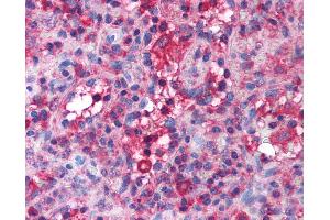 Anti-Band 3 antibody IHC of human spleen.