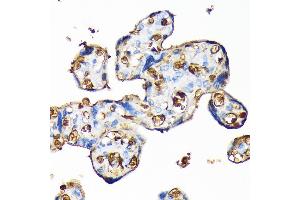 Immunohistochemistry of paraffin-embedded blood cell staining in human placenta using Hemoglobin subunit alpha (HB) (HB) Rabbit mAb (ABIN7267608) at dilution of 1:100 (40x lens).
