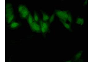 Immunofluorescent analysis of Hela cells using ABIN7170123 at dilution of 1:100 and Alexa Fluor 488-congugated AffiniPure Goat Anti-Rabbit IgG(H+L)
