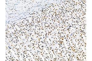 ABIN6256529 and ABIN6267184 at 1/100 staining Rat stomach tissue by IHC-P.