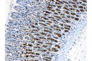 IHC analysis of CD166/ALCAM using anti- CD166/ALCAM antibody .