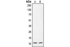 Western blot analysis of CRABP2 expression in A431 (A), HeLa (B) whole cell lysates. (CRABP2 anticorps  (Center))
