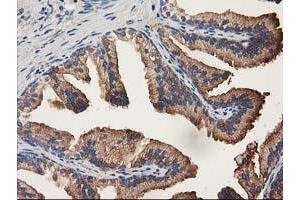 Immunohistochemistry (IHC) image for anti-Aldehyde Dehydrogenase 1 Family, Member A3 (ALDH1A3) (AA 1-100), (AA 413-512) antibody (ABIN1490536)