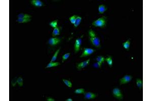 Immunofluorescence staining of Hela cells with ABIN7173883 at 1:60, counter-stained with DAPI. (LTBR anticorps  (AA 31-224))