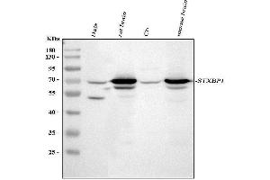 Western blot analysis of STXBP1 using anti-STXBP1 antibody (ABIN3043413). (STXBP1 anticorps  (N-Term))