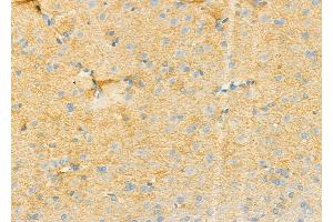ABIN6258722 and ABIN6274757 at 1/100 staining Rat brain tissue by IHC-P. (RPS4Y1 anticorps  (C-Term))
