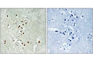 Immunohistochemistry analysis of paraffin-embedded human brain, using GADD45GIP1 Antibody.