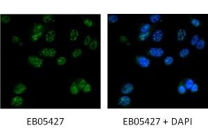 Immunofluorescence staining of MCF7 cells with 5ug/ml ABIN184743 antibody. (DAP3 anticorps  (C-Term))