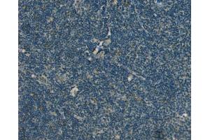 (ABIN185256) Negative Control showing staining of paraffin embedded Human Tonsil, with no primary antibody.