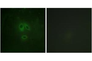 Immunofluorescence analysis of HeLa cells, using n-NOS (Phospho-Ser852) Antibody. (NOS1 anticorps  (pSer852))