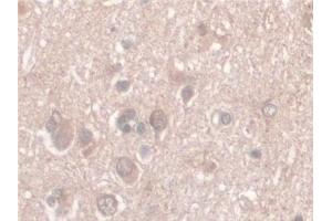 Detection of Nesp2 in Human Cerebrum Tissue using Polyclonal Antibody to Nesprin 2 (Nesp2) (SYNE2 anticorps  (AA 6-296))