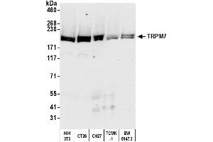 Western Blotting (WB) image for anti-Transient Receptor Potential Cation Channel, Subfamily M, Member 7 (TRPM7) (AA 1815-1865) antibody (ABIN7450962)