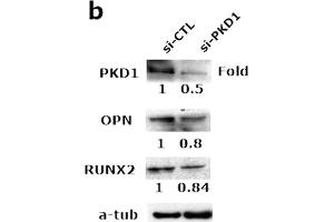 PKD1 contributed to osteoblastic development.