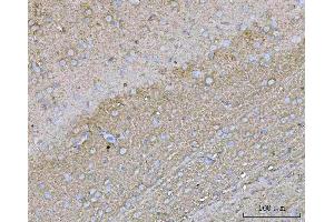 IHC analysis of YWHAE using anti-YWHAE antibody (ABIN7600163). (YWHAE anticorps  (AA 16-163))