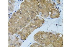 Immunohistochemistry of paraffin-embedded Human stomach using FLT3 Polyclonal Antibody