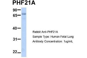 Host:  Rabbit  Target Name:  PHF21A  Sample Type:  Human Fetal Lung  Antibody Dilution:  1. (PHF21A anticorps  (N-Term))