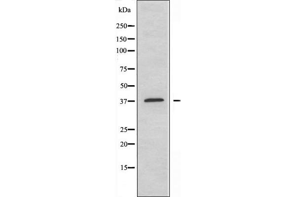 ABHD6 antibody  (Internal Region)