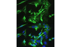Immunofluorescence analysis of U-2OS cells using BMPR2 antibody  at dilution of 1:100.