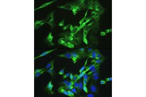 Immunofluorescence analysis of U-2OS cells using BMPR2 antibody  at dilution of 1:100. (BMPR2 anticorps  (AA 27-150))