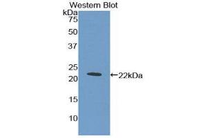 Western Blotting (WB) image for anti-Myeloproliferative Leukemia Virus Oncogene (MPL) (AA 311-460) antibody (ABIN1859873)