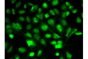 Immunofluorescence analysis of A549 cells using BIRC2 antibody. (BIRC2 anticorps  (AA 1-300))
