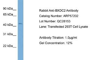 WB Suggested Anti-BXDC2  Antibody Titration: 0. (BRIX1 anticorps  (Middle Region))