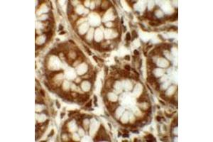 Immunohistochemical staining of human colon cells with LRRFIP2 polyclonal antibody  at 5 ug/mL. (LRRFIP2 anticorps  (C-Term))