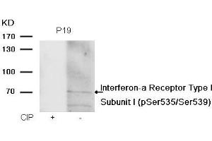 Western blot analysis of extracts from P19 cells, treated with calf intestinal phosphatase (CIP), using Interferon-a Receptor Type I Subunit I (phospho-Ser535/Ser539) Antibody. (IFNAR1 anticorps  (pSer535, pSer539))