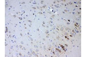 IHC testing of FFPE rat brain tissue with IL15RA antibody at 1ug/ml.