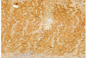 ABIN6260212 and ABIN6272874 at 1/100 staining Rat kidney tissue by IHC-P.