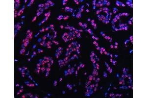IF analysis of TRMT6 using anti-TRMT6 antibody (ABIN7602138). (TRMT6 anticorps  (AA 6-489))